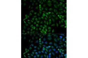 anti-beta-TrCP antibody