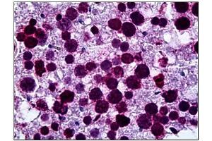 Immunohistochemistry (IHC) image for anti-Fatty Acid Desaturase 1 (FADS1) (AA 1-100) antibody (ABIN782376) (FADS1 抗体  (AA 1-100))