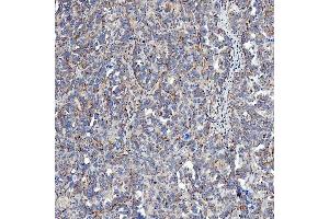 IHC analysis of SFXN5 using anti-SFXN5 antibody (ABIN7601388). (Sideroflexin 5 抗体  (AA 34-340))