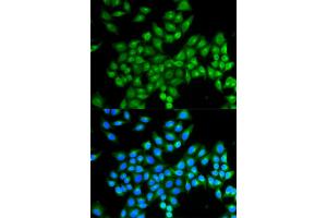Immunofluorescence analysis of MCF-7 cells using DAO antibody (ABIN5973055). (D Amino Acid Oxidase 抗体)