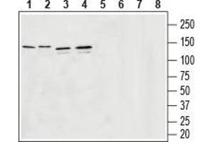 Western blot analysis of rat brain membranes (lanes 1 and 5), mouse brain membranes (lanes 2 and 6), human  MG glyoblastoma lysates (lanes 3 and 7) and human SH-SY5Y brain neuroblastoma lysates (lanes 4 and 8):1-4.