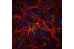 Immunofluorescence analysis of PC-2 cells using CD15 mouse mAb (green). (CD15 抗体)