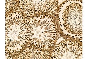 ABIN7094425 and ABIN7098472 at 1/100 staining Rat testis tissue by IHC-P. (SRSF2 抗体  (Internal Region))