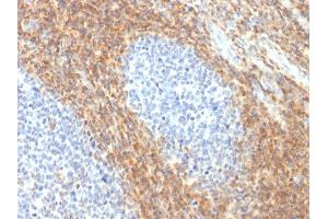 Formalin-fixed, paraffin-embedded human Tonsil stained with CD52 Rabbit Recombinant Monoclonal Antibody (CD52/2276R).