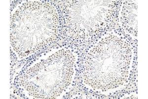 ABIN7095832 and ABIN7099894 at 1/100 staining rat testis tissue by IHC-P. (ARID5A 抗体)
