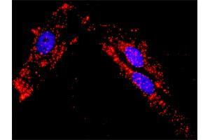 Proximity Ligation Analysis of protein-protein interactions between PXN and CTTN. (Paxillin 抗体  (AA 1-262))