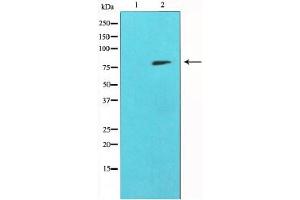Western Blotting (WB) image for anti-Matrix Metallopeptidase 9 (Gelatinase B, 92kDa Gelatinase, 92kDa Type IV Collagenase) (MMP9) (C-Term) antibody (ABIN6263289)
