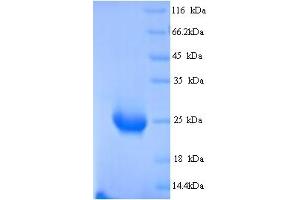 SDS-PAGE (SDS) image for butyrophilin, Subfamily 2, Member A1 (BTN2A1) (AA 29-248) protein (His tag) (ABIN5714396)