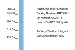 WB Suggested Anti-TFDP3  Antibody Titration: 0. (TFDP3 抗体  (Middle Region))