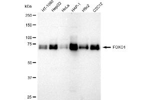 Western blotting analysis using FOXO1 antibody (ABIN7798643). (Recombinant FOXO1 抗体)