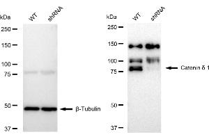 Western blotting analysis using Catenin δ 1 antibody (ABIN7797934).