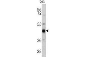 Western blot analysis of KRT13 antibody (N-term) in 293 cell line lysates (35ug/lane). (Cytokeratin 13 抗体  (N-Term))
