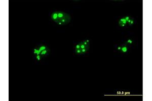 Immunofluorescence of purified MaxPab antibody to GNL3 on HeLa cell. (Nucleostemin 抗体  (AA 1-549))