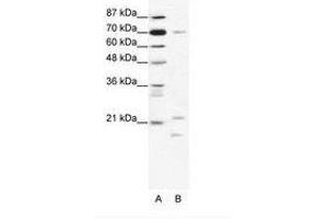 Image no. 1 for anti-Basic Transcription Factor 3 (BTF3) (C-Term) antibody (ABIN203029) (BTF3 抗体  (C-Term))