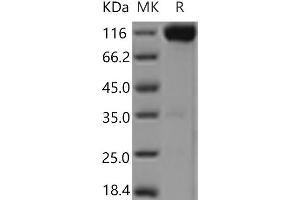 Western Blotting (WB) image for Mast/stem Cell Growth Factor Receptor (KIT) protein (Fc Tag) (ABIN7321132)