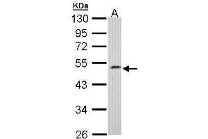 WB Image Sample (30 ug of whole cell lysate) A: Hep G2 , 10% SDS PAGE antibody diluted at 1:1000 (C17orf75 抗体)
