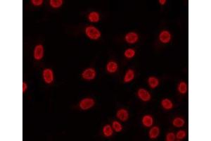 ABIN6268972 staining HeLa by IF/ICC. (Cyclin H 抗体  (pThr315))