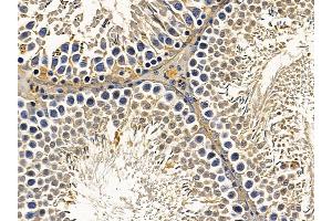 ABIN7094026 and ABIN7098070 at 1/100 staining rat testis tissue by IHC-P. (TRIM11 抗体  (N-Term))