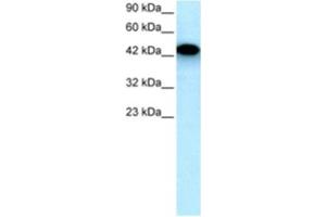Western Blotting (WB) image for anti-Eyes Absent Homolog 3 (EYA3) antibody (ABIN2460428) (EYA3 抗体)