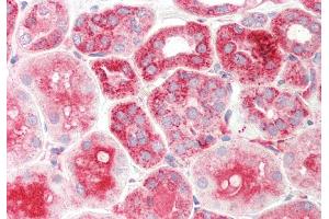 Rabbit Anti-TXN2 antibody Catalog Number: ARP54909 Formalin Fixed Paraffin Embedded Tissue: Human Kidney Primary antibody Concentration: 1:100 Secondary Antibody: Donkey anti-Rabbit-Cy3 Secondary Antibody Concentration: 1:200 Magnification: 20x Exposure Time: 0. (TXN2 抗体  (Middle Region))