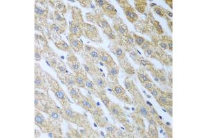 Immunohistochemistry of paraffin-embedded human liver using Eif2ak2 antibody (ABIN5973251) at dilution of 1/100 (40x lens). (EIF2AK2 抗体)