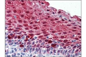 Human Tonsil: Formalin-Fixed, Paraffin-Embedded (FFPE) (MARK4 抗体  (Internal Region))