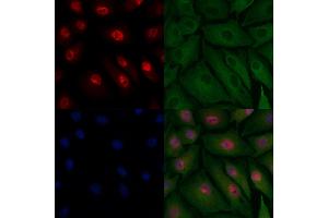 ABIN6262242 and ABIN6278080 staining  cells by IF/ICC. (HIPK2 抗体  (N-Term))