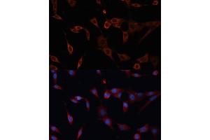 Immunofluorescence analysis of NIH/3T3 cells using PDI antibody (ABIN6128422, ABIN6145387, ABIN6145388 and ABIN6216541) at dilution of 1:100. (PDIA2 抗体  (AA 326-525))