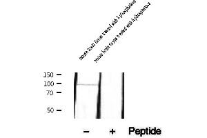 Western blot analysis of extracts of mouse brain tissue treated with phosphatase, using Phospho-PSD95 (Ser295) Antibody.