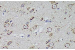 Immunohistochemistry of paraffin-embedded Rat brain using PSAP Polyclonal Antibody at dilution of 1:200 (40x lens). (Prosaposin 抗体)