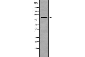 Western blot analysis of ZNF839 using HUVEC whole cell lysates (ZNF839 抗体  (Internal Region))