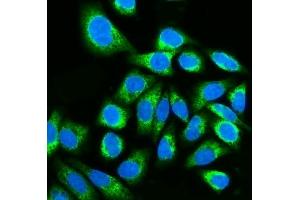 IF analysis of Kinectin 1/KTN1 using anti-Kinectin 1/KTN1 antibody (ABIN7601096).