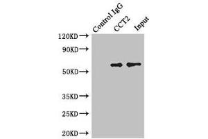 Immunoprecipitating CCT2 in Jurkat whole cell lysate Lane 1: Rabbit control IgG instead of (1 μg) instead of ABIN7171416 in Jurkat whole cell lysate. (CCT2 抗体  (AA 206-535))