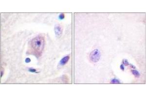 Immunohistochemistry analysis of paraffin-embedded human brain tissue, using CDC6 (Ab-54) Antibody. (CDC6 抗体  (AA 20-69))