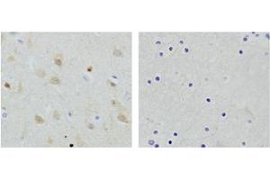 Immunohistochemistry analysis of human brain tissue slide (Paraffin embedded) using Rabbit Anti-NSE Polyclonal Antibody (Left, ABIN398879) and Purified Rabbit IgG (Whole molecule) Control (Right, ABIN398653) (ENO2/NSE 抗体  (N-Term))