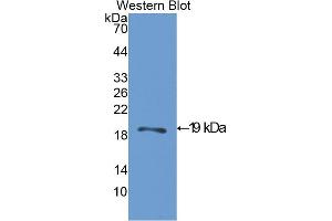 Western blot analysis of the recombinant protein. (ACP1 抗体  (AA 1-158))