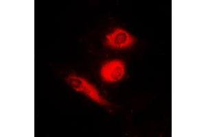 Immunofluorescent analysis of FOXO4 (pS197) staining in HeLa cells. (FOXO4 抗体  (pSer197))