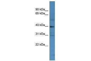 MAGEC2 antibody used at 0. (MAGEC2 抗体  (N-Term))