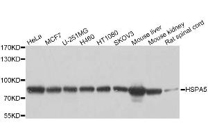 Western blot analysis of extracts of various cell lines, using HSPA5 antibody (ABIN5997936) at 1/1000 dilution. (GRP78 抗体)