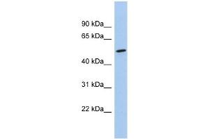 NKD1 antibody used at 1 ug/ml to detect target protein. (NKD1 抗体)
