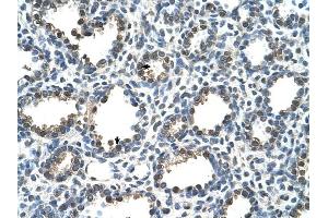 RAD23A antibody was used for immunohistochemistry at a concentration of 4-8 ug/ml to stain Alveolar cells (arrows) in Human Lung. (RAD23A 抗体)