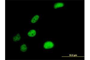 Immunofluorescence of purified MaxPab antibody to SLC4A1AP on HeLa cell. (NADAP 抗体  (AA 1-796))