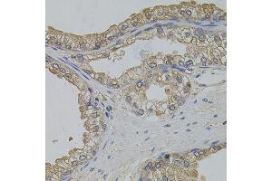 Immunohistochemistry of paraffin-embedded human prostate using ARF1 antibody. (ARF1 抗体)