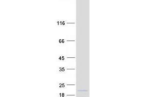 Validation with Western Blot
