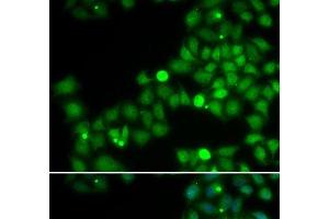 Immunofluorescence analysis of U2OS cells using POLK Polyclonal Antibody (POLK 抗体)