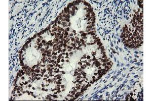 Image no. 9 for anti-Myeloid Leukemia Factor 1 (MLF1) antibody (ABIN1499493) (MLF1 抗体)