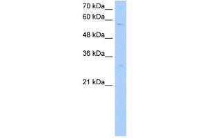 STEAP4 antibody used at 1 ug/ml to detect target protein. (STEAP4 抗体  (C-Term))