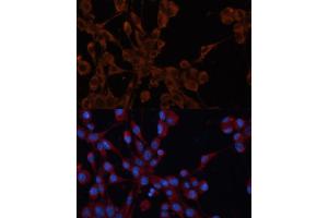 Immunofluorescence analysis of NIH/3T3 cells using Cation-independent M6PR (Cation-independent M6PR (IGF2R)) antibody (ABIN6130063, ABIN6142247, ABIN6142248 and ABIN6216853) at dilution of 1:100.