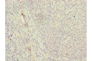 Immunohistochemistry of paraffin-embedded human tonsil tissue using ABIN7142250 at dilution of 1:100 (MRPS16 抗体  (AA 1-137))