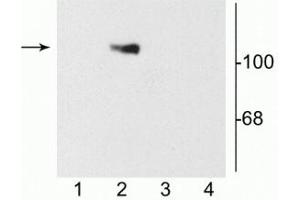 Western blot of 10 µg of HEK 293 cells showing specific immunolabeling of the ~120 kDa NR1 subunit of the NMDA receptor containing the C2 splice variant insert (lane 2). (GRIN1/NMDAR1 抗体)